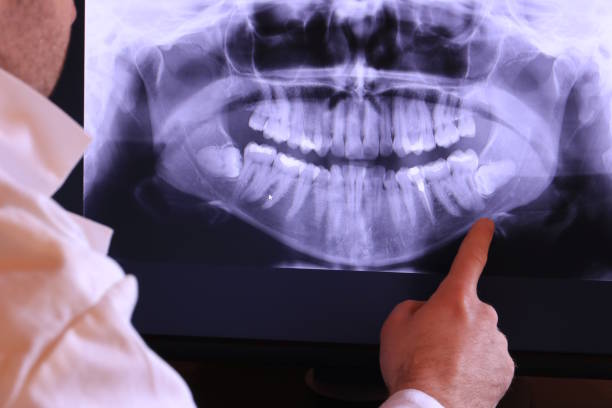 Best Dental Abscess Treatment in Dalton, OH